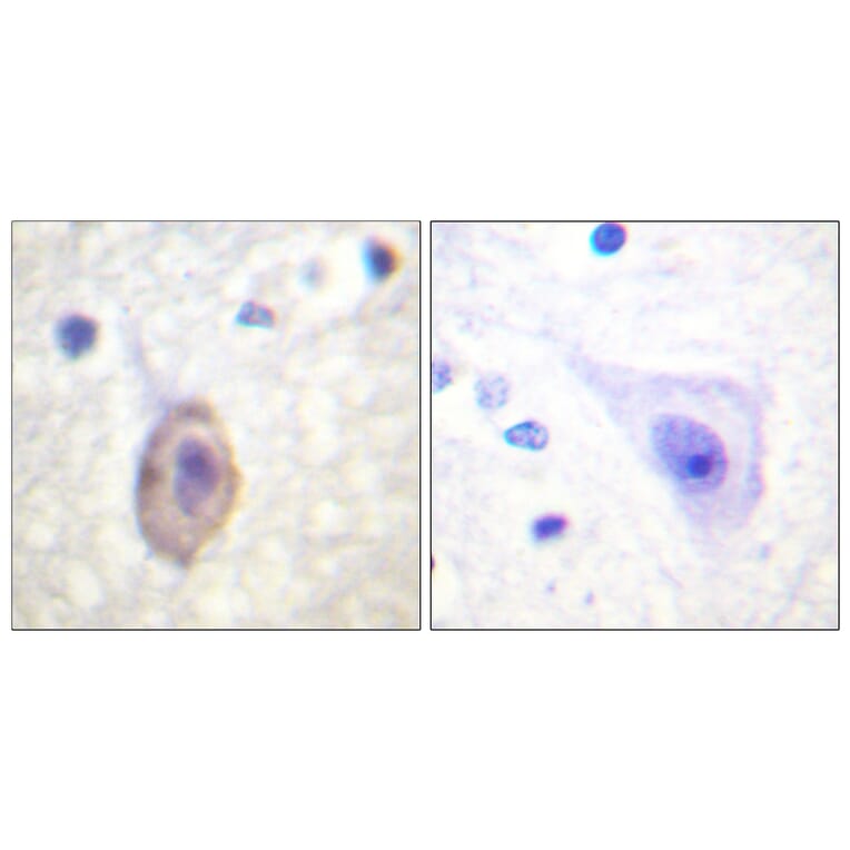 Immunohistochemistry - Anti-VEGFR1 Antibody (B0594) - Antibodies.com