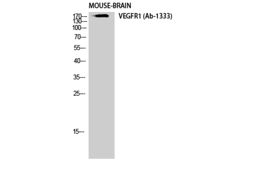 Western Blot - Anti-VEGFR1 Antibody (B0594) - Antibodies.com