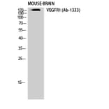 Western Blot - Anti-VEGFR1 Antibody (B0594) - Antibodies.com