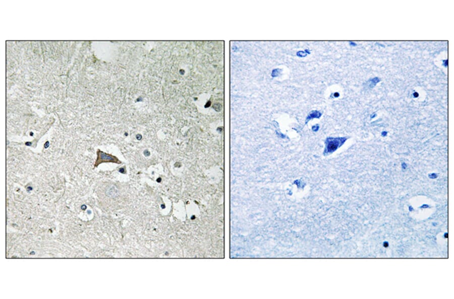 Immunohistochemistry - Anti-VEGFR1 Antibody (B8198) - Antibodies.com