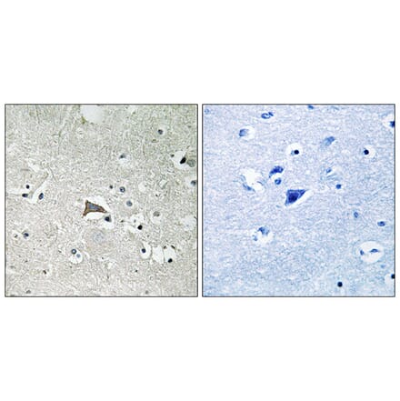 Immunohistochemistry - Anti-VEGFR1 Antibody (B8198) - Antibodies.com