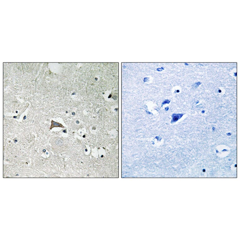 Immunohistochemistry - Anti-VEGFR1 Antibody (B8198) - Antibodies.com
