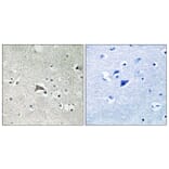 Immunohistochemistry - Anti-VEGFR1 Antibody (B8198) - Antibodies.com