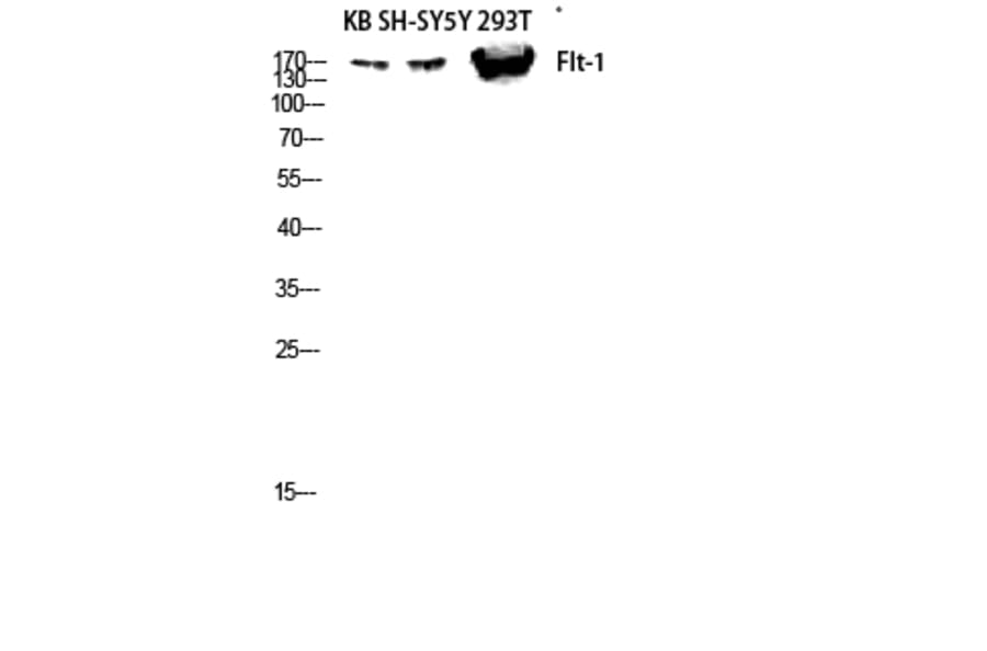 Western Blot - Anti-VEGFR1 Antibody (B8198) - Antibodies.com