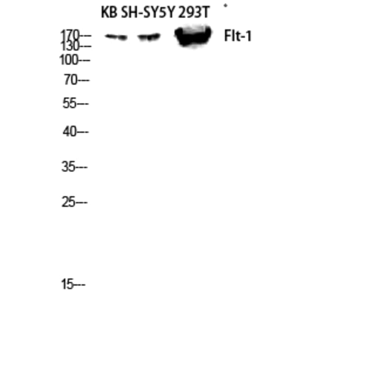 Western Blot - Anti-VEGFR1 Antibody (B8198) - Antibodies.com