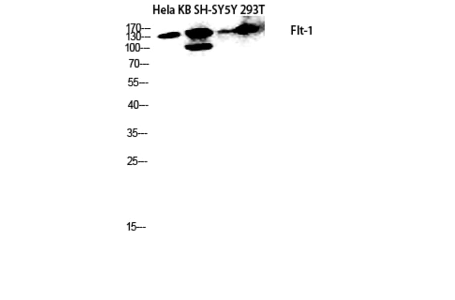 Western Blot - Anti-VEGFR1 Antibody (B8198) - Antibodies.com
