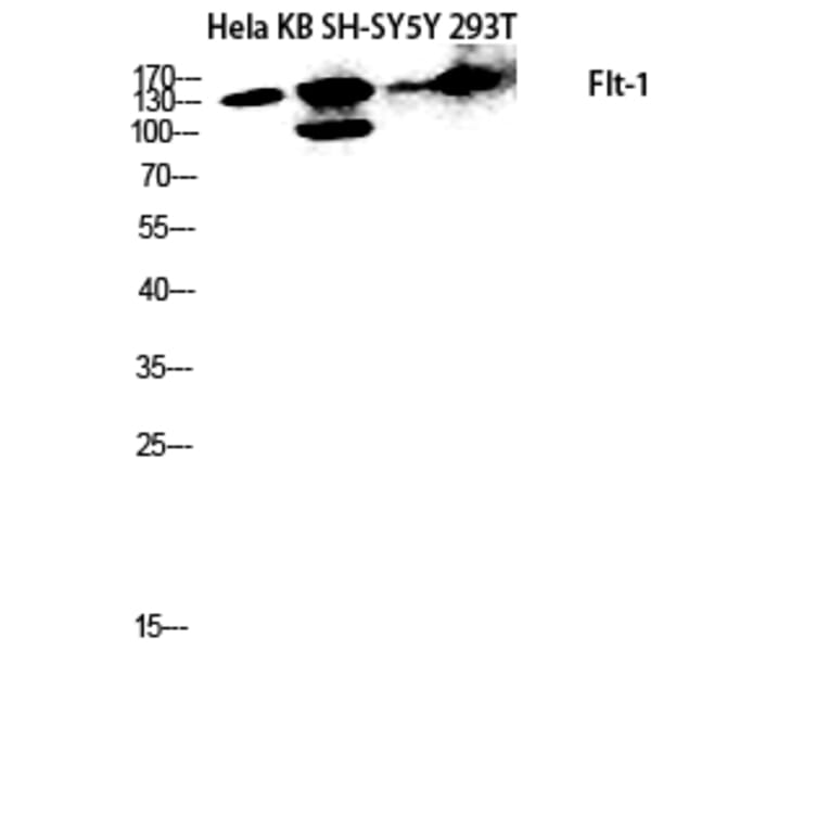 Western Blot - Anti-VEGFR1 Antibody (B8198) - Antibodies.com