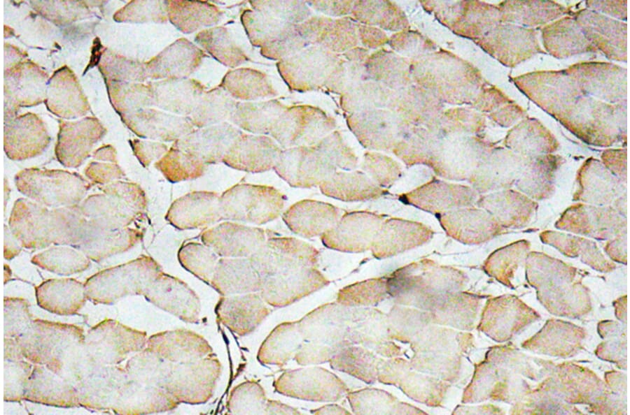 Immunohistochemistry - Anti-VEGF-A Antibody (R12-2407) - Antibodies.com