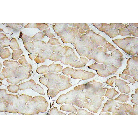 Immunohistochemistry - Anti-VEGF-A Antibody (R12-2407) - Antibodies.com