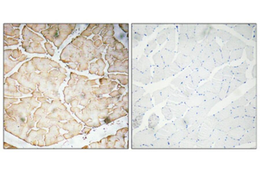 Immunohistochemistry - Anti-VEGF-A Antibody (R12-2407) - Antibodies.com