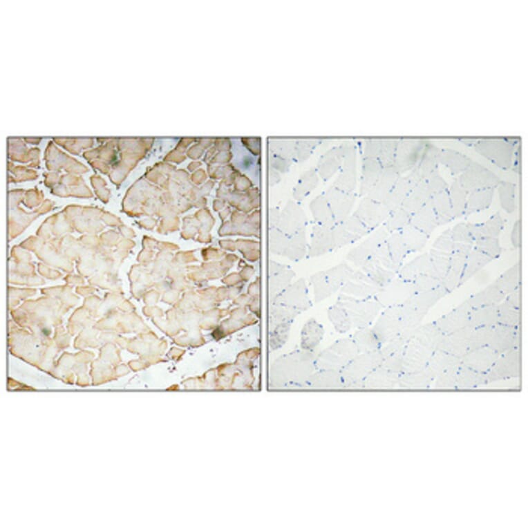 Immunohistochemistry - Anti-VEGF-A Antibody (R12-2407) - Antibodies.com