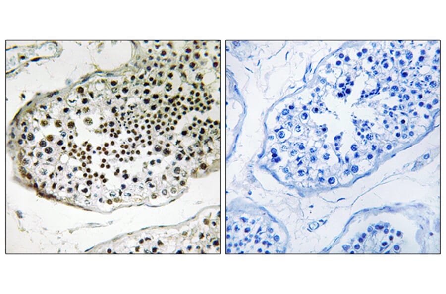 Immunohistochemistry - Anti-UBQLN3 Antibody (C19353) - Antibodies.com