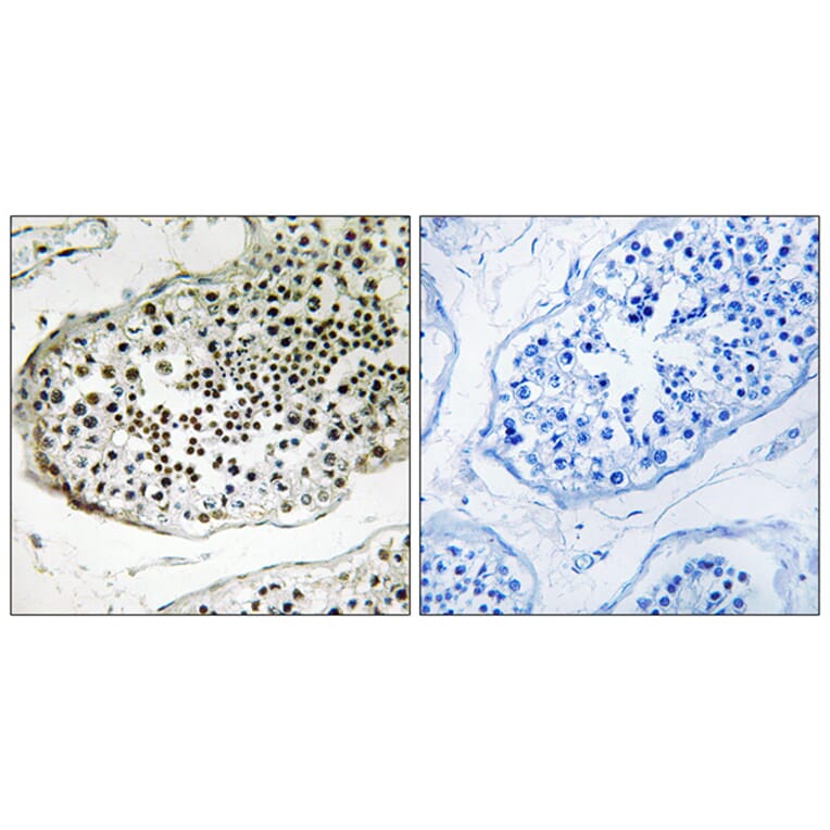 Immunohistochemistry - Anti-UBQLN3 Antibody (C19353) - Antibodies.com