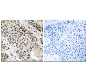 Immunohistochemistry - Anti-TNNI3K Antibody (C18622) - Antibodies.com