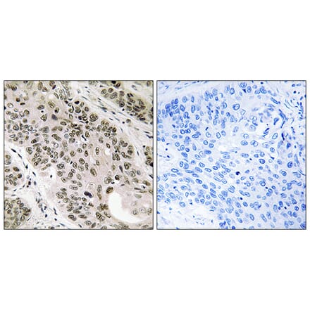 Immunohistochemistry - Anti-TNNI3K Antibody (C18622) - Antibodies.com