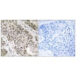 Immunohistochemistry - Anti-TNNI3K Antibody (C18622) - Antibodies.com