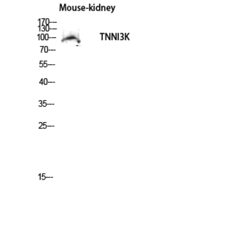 Western Blot - Anti-TNNI3K Antibody (C18622) - Antibodies.com