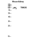 Western Blot - Anti-TNNI3K Antibody (C18622) - Antibodies.com