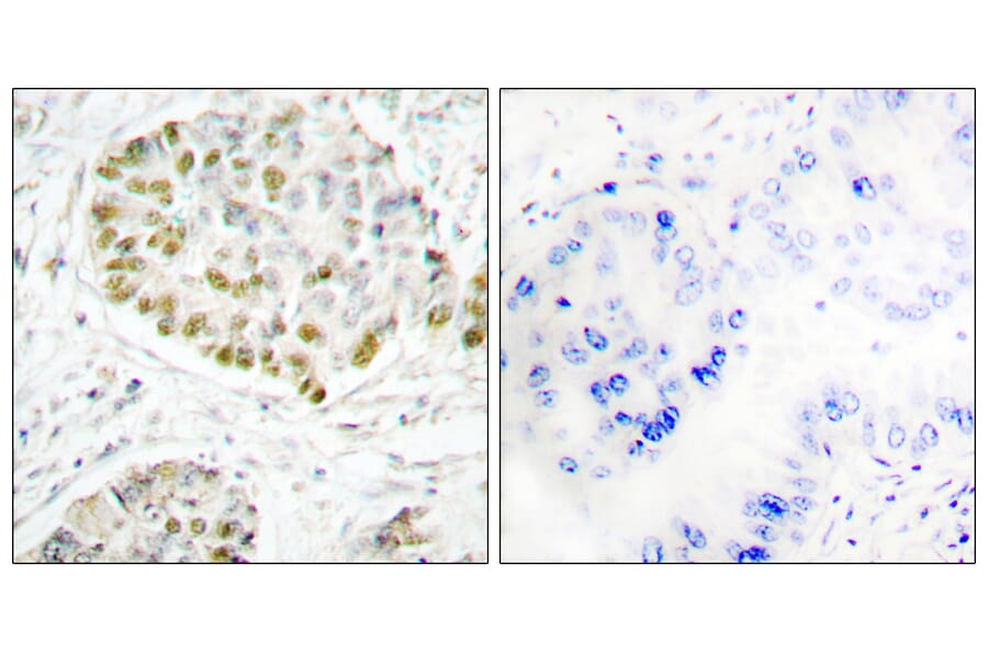 Immunohistochemistry - Anti-STAT5A Antibody (B1008) - Antibodies.com