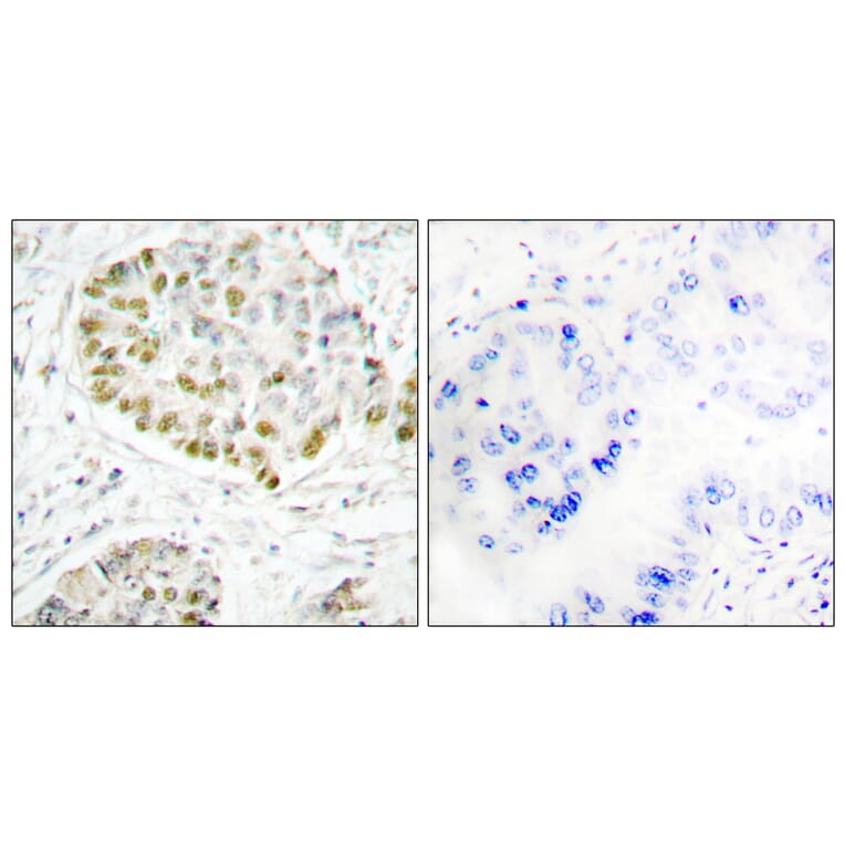 Immunohistochemistry - Anti-STAT5A Antibody (B1008) - Antibodies.com
