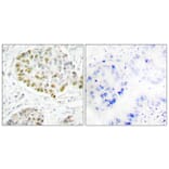 Immunohistochemistry - Anti-STAT5A Antibody (B1008) - Antibodies.com