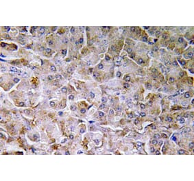 Immunohistochemistry - Anti-SEMA3C Antibody (R12-2352) - Antibodies.com