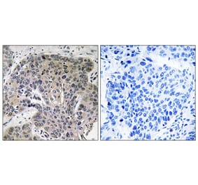Immunohistochemistry - Anti-S100A3 Antibody (C18046) - Antibodies.com