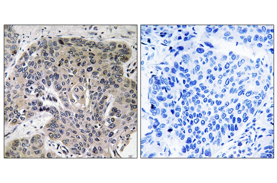 Immunohistochemistry - Anti-S100A3 Antibody (C18046) - Antibodies.com