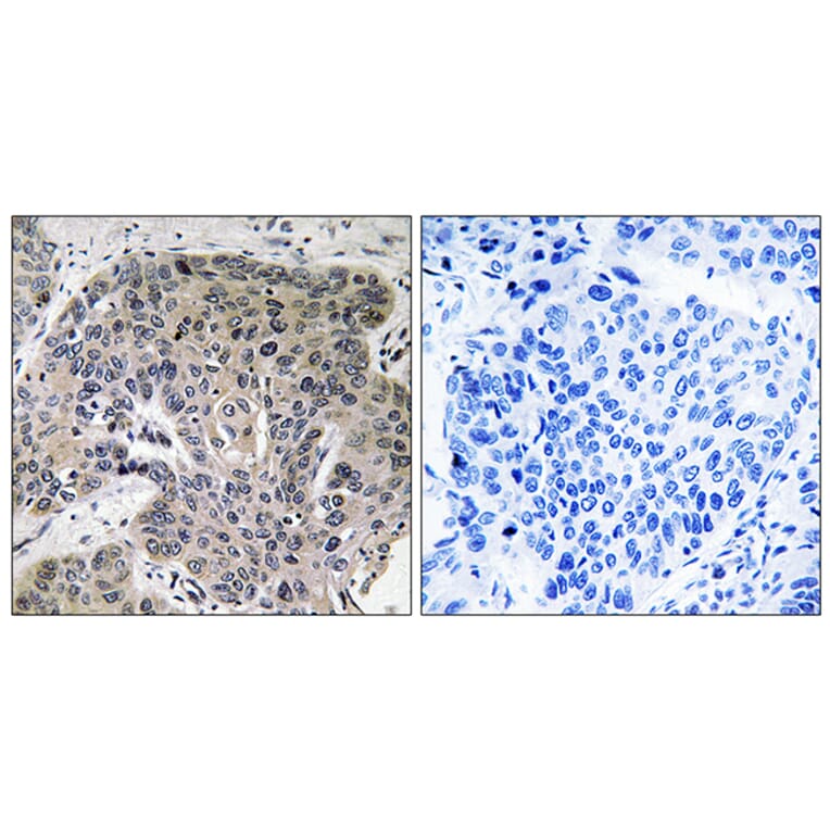 Immunohistochemistry - Anti-S100A3 Antibody (C18046) - Antibodies.com