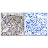 Immunohistochemistry - Anti-S100A3 Antibody (C18046) - Antibodies.com