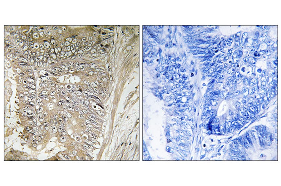 Immunohistochemistry - Anti-RPL37A Antibody (C14179) - Antibodies.com
