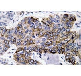 Immunohistochemistry - Anti-RANTES Antibody (R12-2329) - Antibodies.com