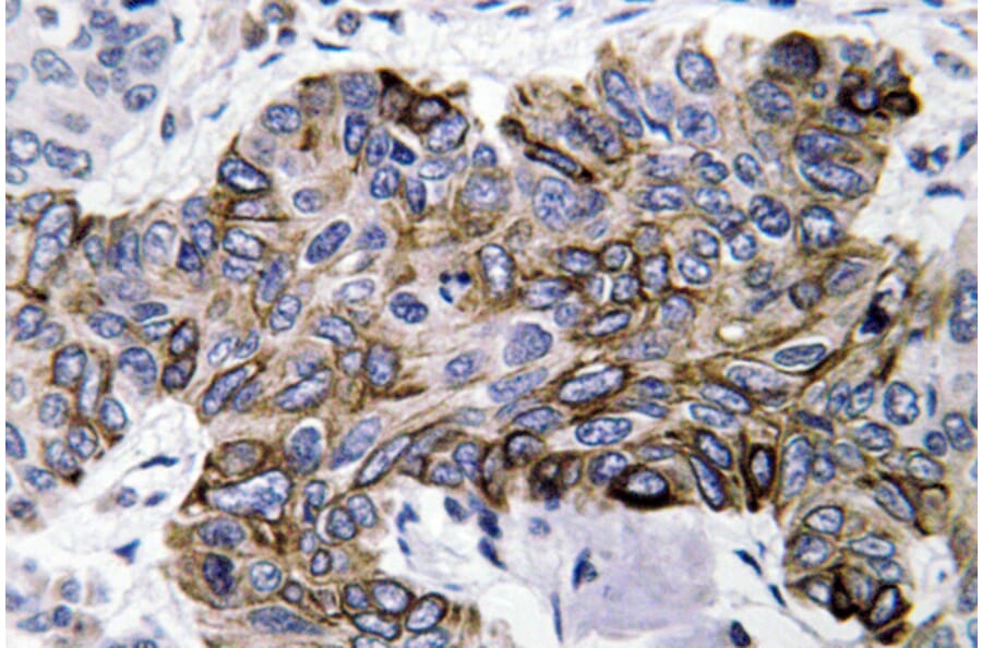 Immunohistochemistry - Anti-RANTES Antibody (R12-2329) - Antibodies.com
