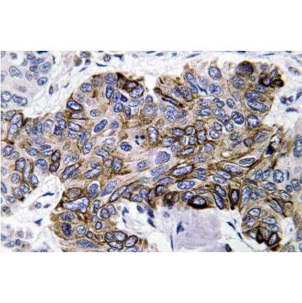 Immunohistochemistry - Anti-RANTES Antibody (R12-2329) - Antibodies.com