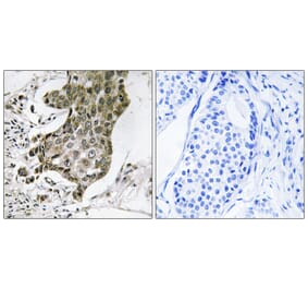 Immunohistochemistry - Anti-RABEP1 Antibody (C18115) - Antibodies.com