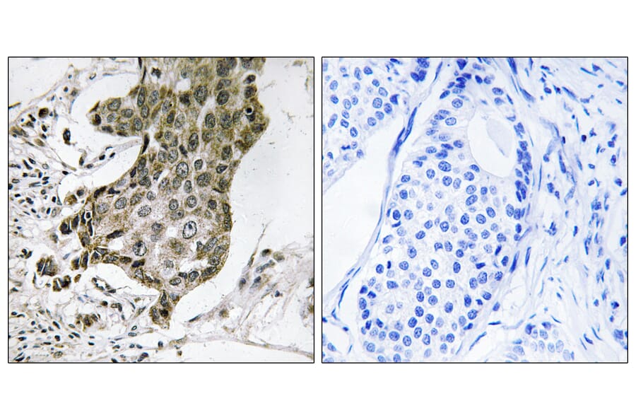 Immunohistochemistry - Anti-RABEP1 Antibody (C18115) - Antibodies.com