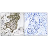 Immunohistochemistry - Anti-RABEP1 Antibody (C18115) - Antibodies.com