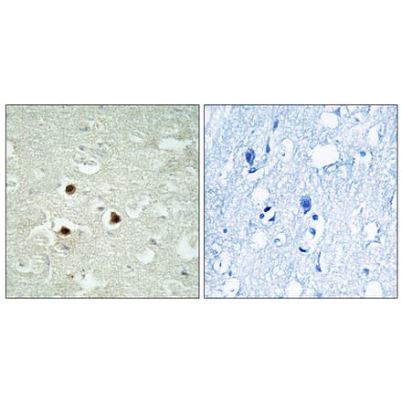 Immunohistochemistry - Anti-RAB3IP Antibody (C18126) - Antibodies.com