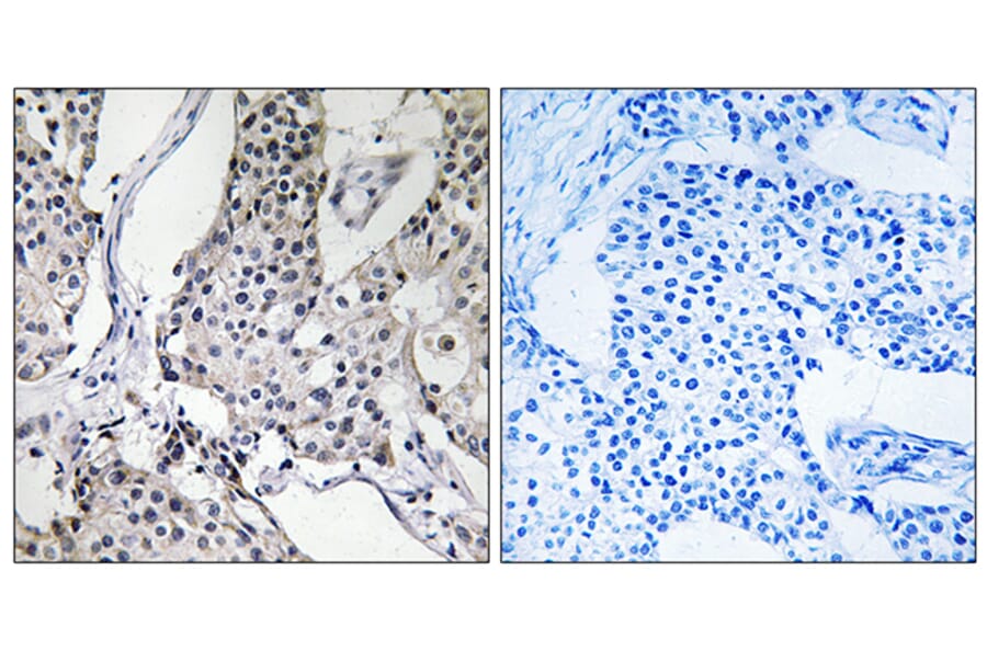 Immunohistochemistry - Anti-PHLDA3 Antibody (C13102) - Antibodies.com