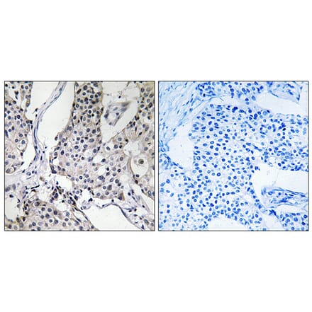 Immunohistochemistry - Anti-PHLDA3 Antibody (C13102) - Antibodies.com
