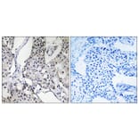 Immunohistochemistry - Anti-PHLDA3 Antibody (C13102) - Antibodies.com