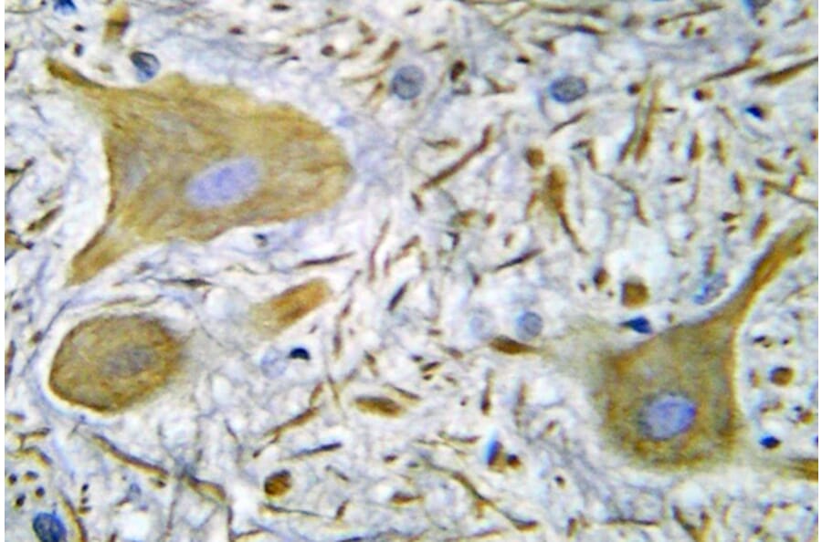 Immunohistochemistry - Anti-NMDAR1 Antibody (R12-2267) - Antibodies.com