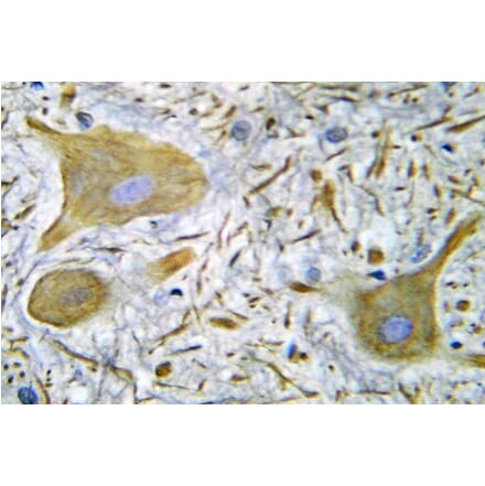 Immunohistochemistry - Anti-NMDAR1 Antibody (R12-2267) - Antibodies.com