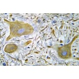 Immunohistochemistry - Anti-NMDAR1 Antibody (R12-2267) - Antibodies.com