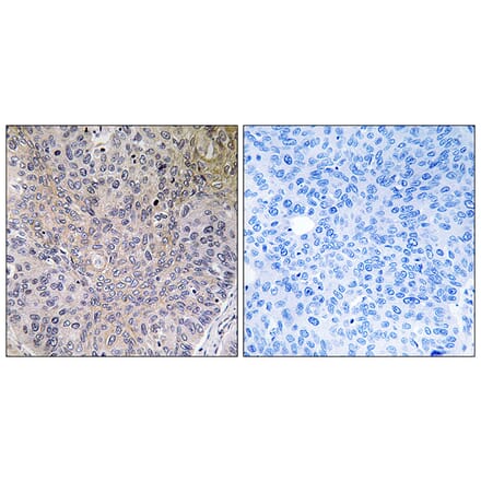 Immunohistochemistry - Anti-NDUFS7 Antibody (C16849) - Antibodies.com