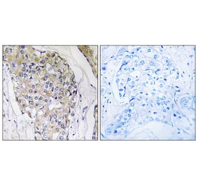 Immunohistochemistry - Anti-NDUFS6 Antibody (C16848) - Antibodies.com