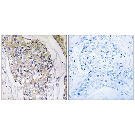 Immunohistochemistry - Anti-NDUFS6 Antibody (C16848) - Antibodies.com