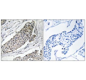 Immunohistochemistry - Anti-KCNAB3 Antibody (C19548) - Antibodies.com