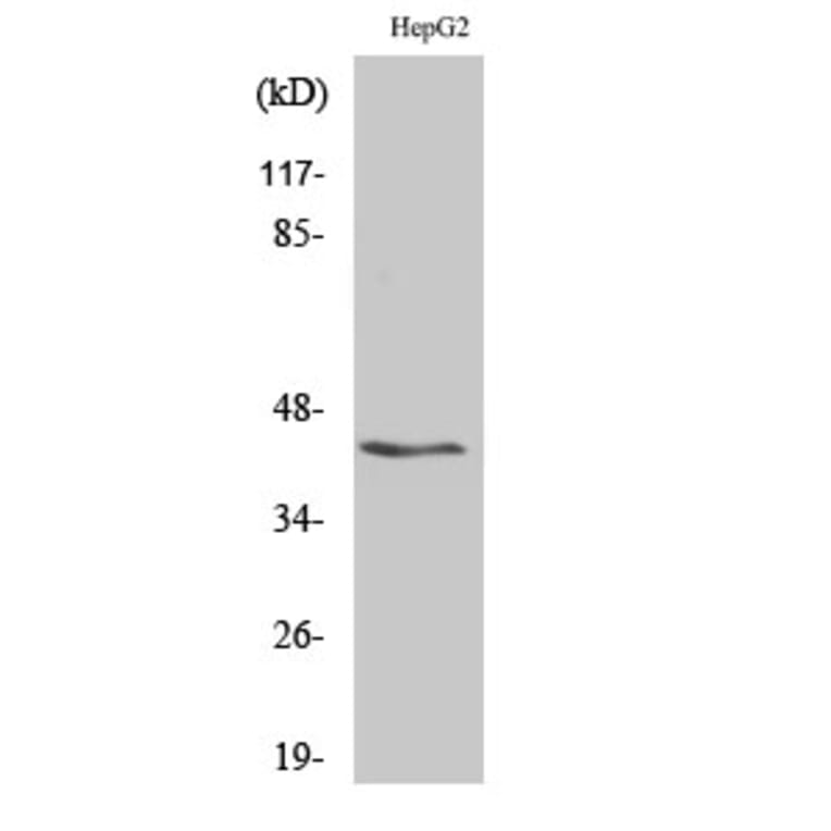 Western Blot - Anti-KCNAB3 Antibody (C19548) - Antibodies.com