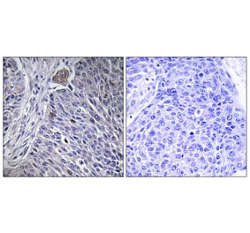 Immunohistochemistry - Anti-HNRPDL Antibody (C16111) - Antibodies.com